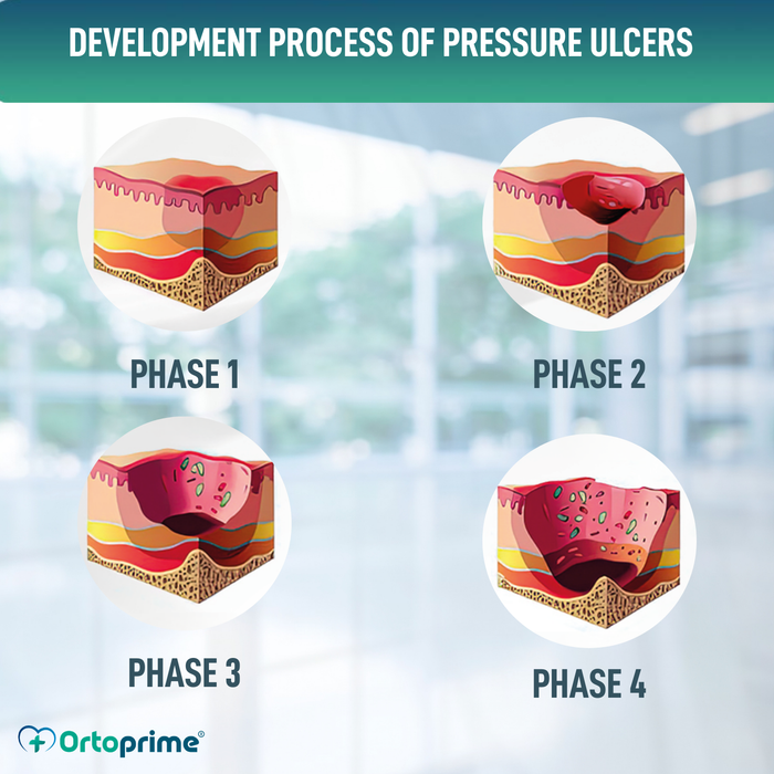 Viscoelastic Pressure Sore Cushion for Coccyx 60kg/m3
