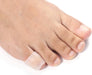 comfort‑gel‑toe‑guards‑toe‑covers‑s‑m‑l‑ortoprime‑uk