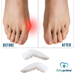 hallux-valgus-correction-toe-kit-ortoprime-uk