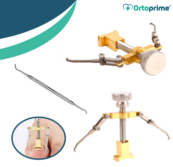 home‑pedicure‑ingrown‑nail‑correction‑set‑ortoprime-uk