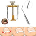 ingrown‑toenail‑correction‑kit‑stainless‑steel‑ortoprime-uk