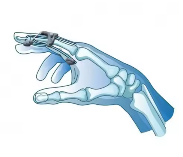 lightweight-postoperative-shoe-for-foot-rehab-xs-s-m-l-ortoprime-uk