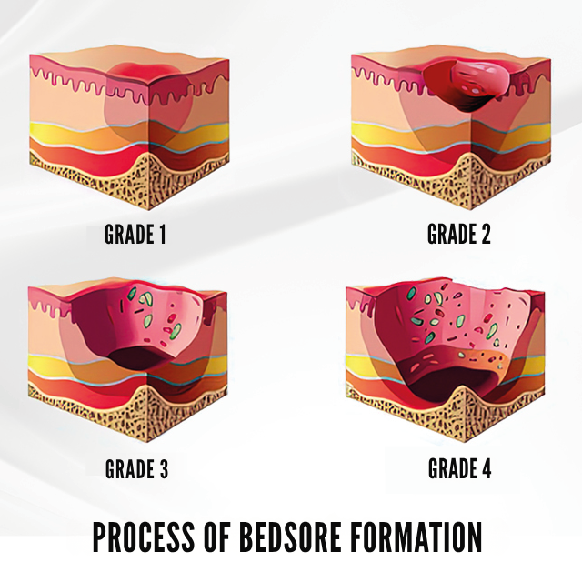 soft-velcro-heel-support-pads-ortoprime-uk